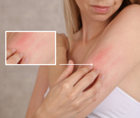 Swędząca skóra może być objawem choroby?